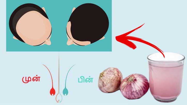 how to use onion sites